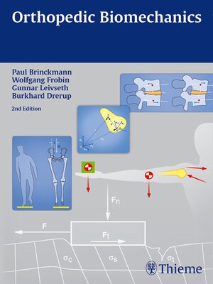 cover image of Orthopedic Biomechanics